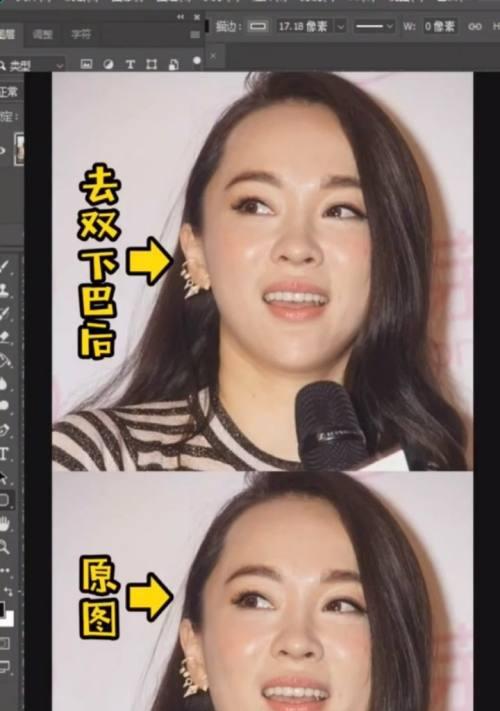 如何减掉双下巴(有效方法和技巧)